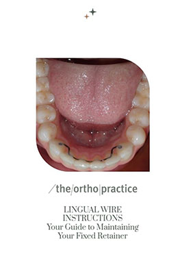 Fixed Lingual Wire Retainer Instructions