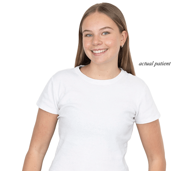 Orthodontic treatment