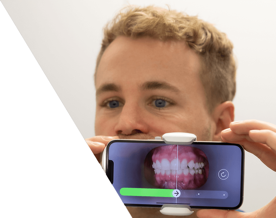 Dental Monitoring