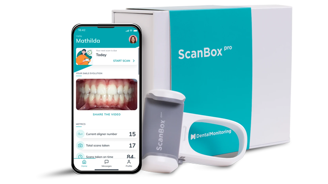 Dental Monitoring